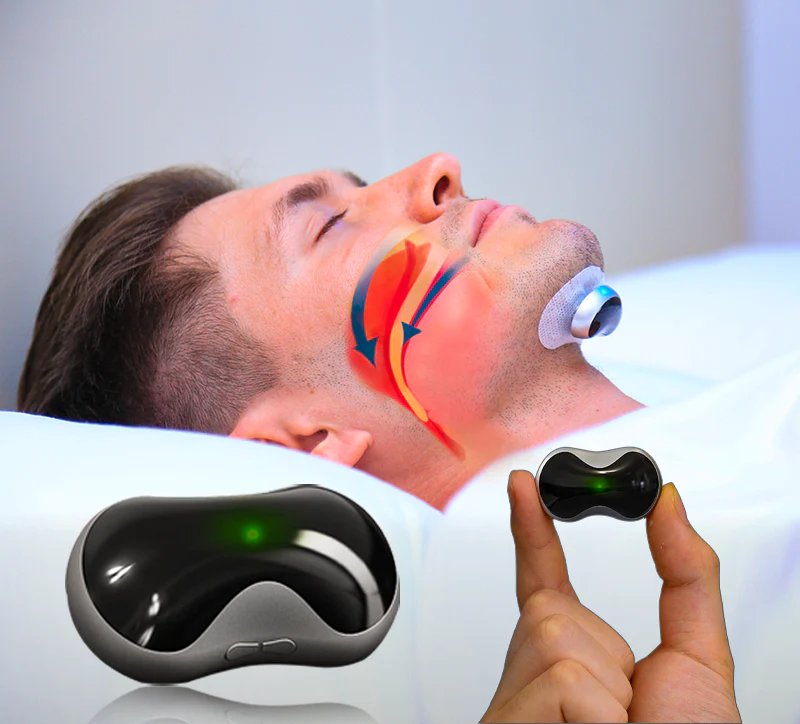 Anti-Snurk Device met Elektro-Stimulatie Technologie – Comfortabele Snurk Mondstuk voor Betere Slaapkwaliteit